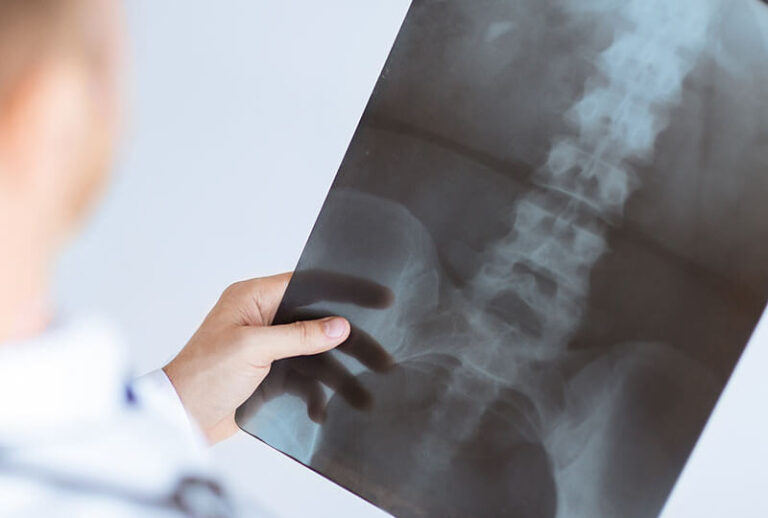 Burlington Chiropractic Clinic logo