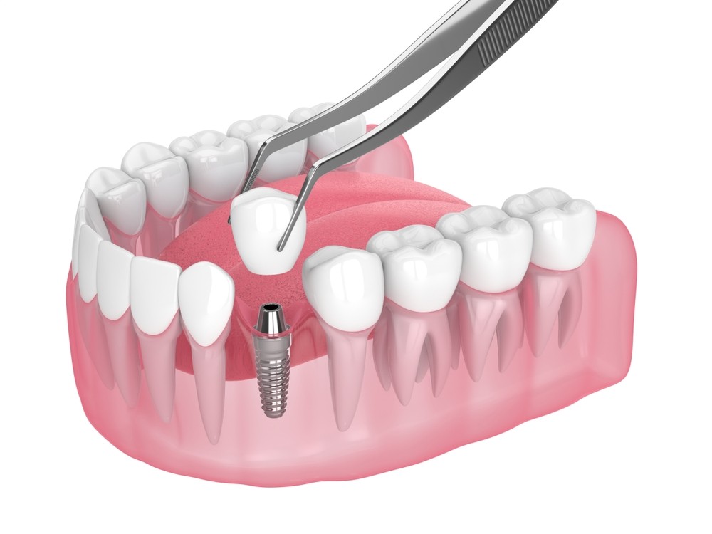 A photo of a smiling dentist examining teeth with a patient, conveying professionalism and trustworthiness